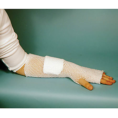 MT Spandage™ Tubular Elastic Retainer (Non-Reinforced), Small Axilla/Back/Chest/Perineum, 25 Yd.