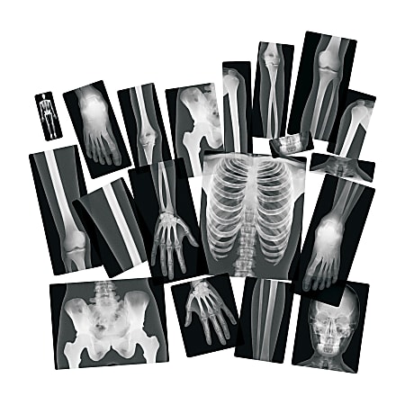 Roylco Human X-ray Theme/subject: Radiology 18 Skill Learning: Radiography 