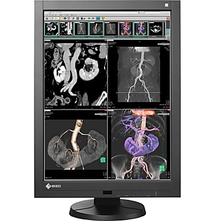 Eizo RadiForce RX340 21.2" LED LCD Monitor - 22 ms