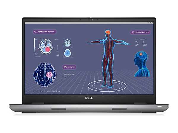 Dell Precision 7000 7780 17.3" Mobile Workstation - Intel Core i7 - 32 GB Total RAM - 512 GB SSD - Aluminum Titan Gray - Windows 11 Pro - NVIDIA RTX 2000 Ada with 8 GB
