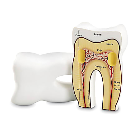 Learning Resources Cross-Section Tooth Model, 5", Grade 3 - 7